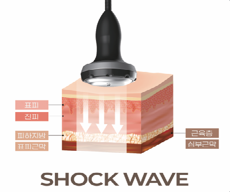 Shock Wave 심부 침투 시각화
